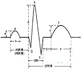 心电图波形 