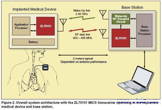 ZL70101工作于植入设备和外部基站