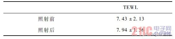 照射前后TEWL 的变化