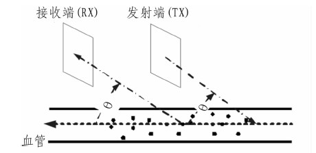 圖1 血液速度檢測原理圖