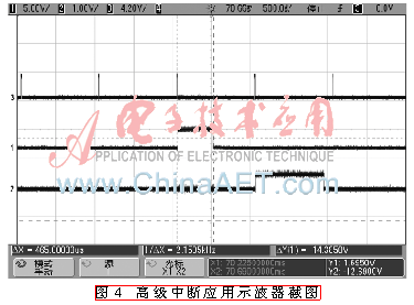 qrs3-t4.gif