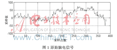 基于压缩感知的脑电信号重构研究