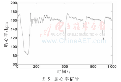 qrs7-t5.gif