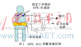 EPIC ECG穿戴装置的心脏疾病预警算法研究