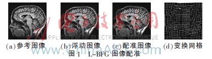基于活动轮廓模型的脑部医学图像弹性配准