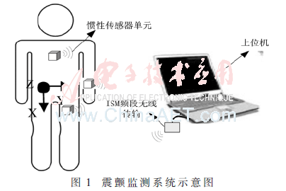 qrs1-t1.gif