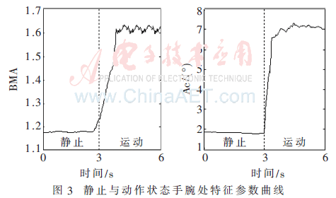 qrs1-t3.gif