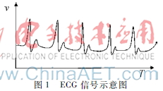 基于心电脉搏信号的无创血压算法研究