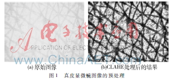 面向真皮顯微鏡圖像的邊緣空間重疊度閾值分割