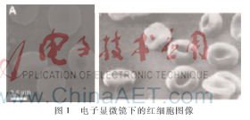 紅細胞SEM圖像的三維重構及形狀特征提取