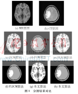 基于改進的FLICM的醫(yī)學圖像分割研究