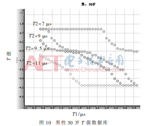 qrs3-t10.gif