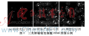 腫瘤癌變細(xì)胞FISH圖像分析系統(tǒng)的研究
