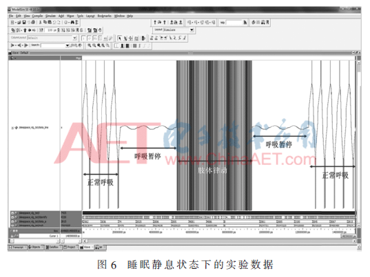 qrs2-t6.gif