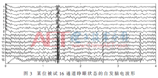 ck1-t3.gif