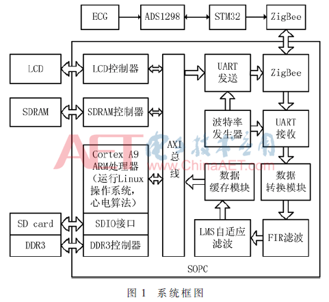 qrs2-t1.gif